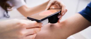 Using a mobile hyperspectral camera to analyse human skin
